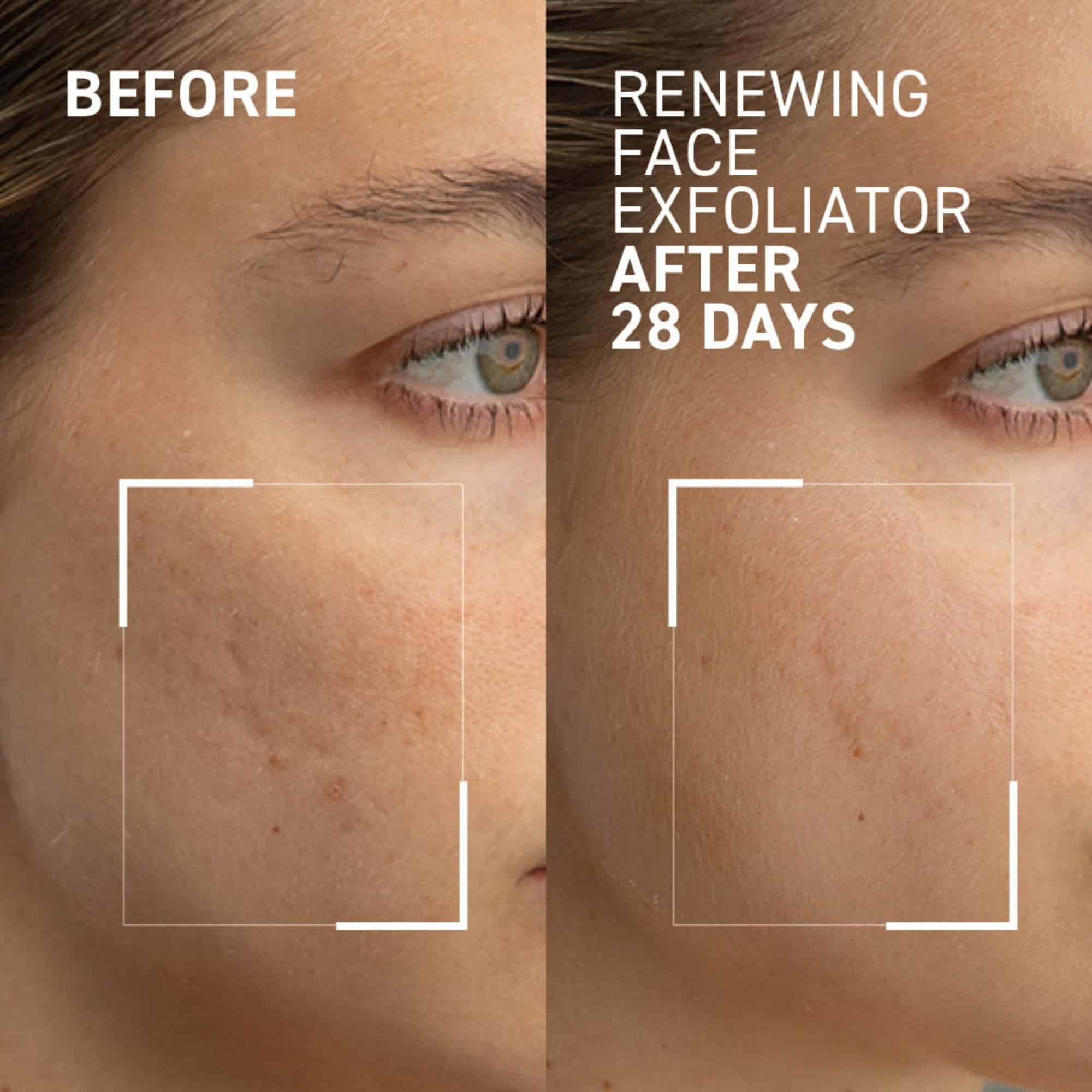 Alternative view of Dr. Brandt Microdermabrasion Renewing Face Exfoliator -