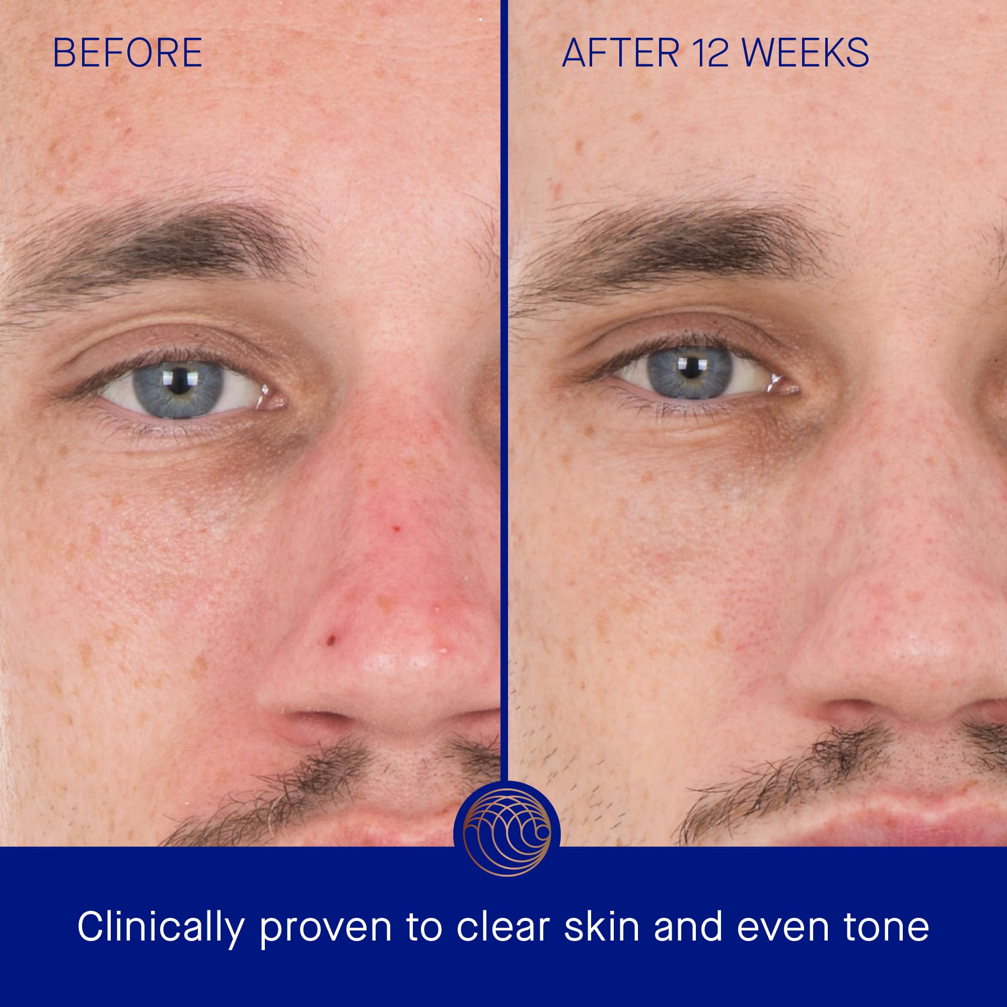 Alternative view of Sérum de Retinol Augustinus Bader 30ml