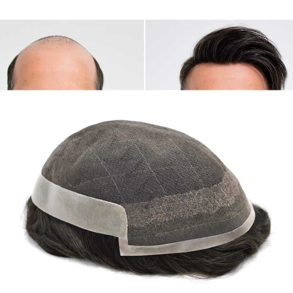 Pelucas para hombres con sistema de reemplazo de cabello