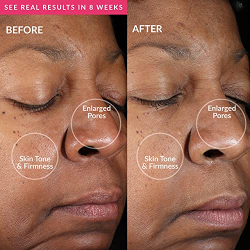 PMD Beauty Clean Mini - Dispositivo de limpieza facial - Imagen 5