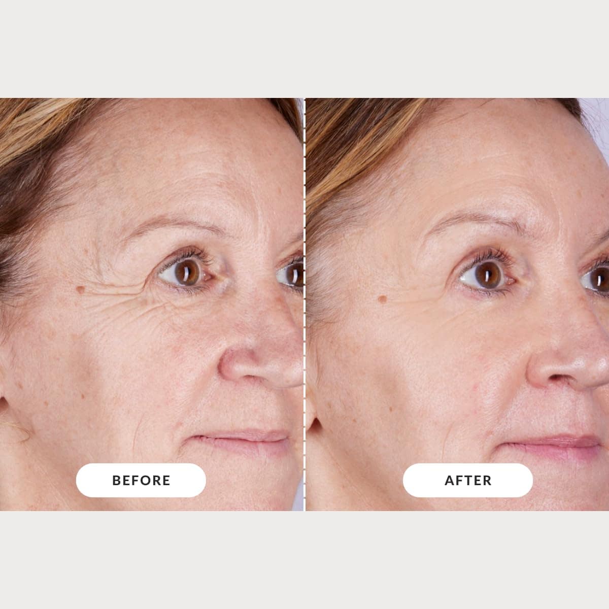 Mascarilla de Terapia de Luz LED CurrentBody Skin: Serie 2 - Imagen 6
